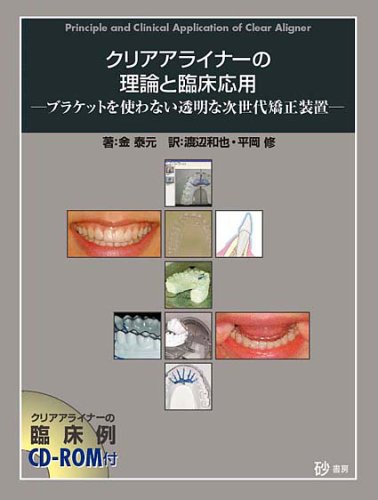 クリアアライナーの理論と臨床応用: ブラケットを使わない透明な次世代