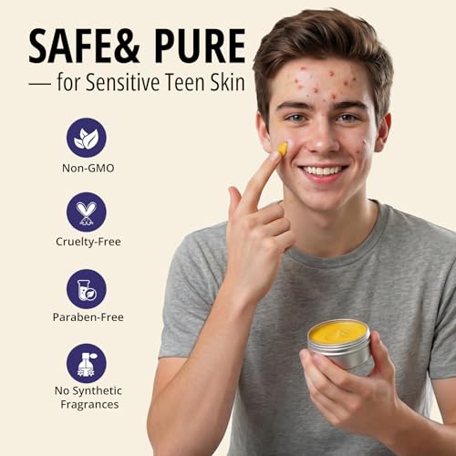 Bealions Organics Ance Killer Night Balm - Acid-Free Acne Treatment for Teens & Adults - Non-Greasy Pimple Cream for Hormonal Breakouts & Redness - Sensitive Skin Safe, 30g |1oz
