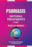 Psoriasis: Natural Treatments That Really Work!