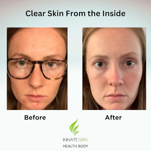 Innate Skin Clear Skin Vitamin System