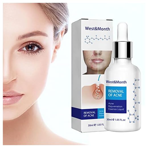 Pore ​​Shrinking Essence,Pimples Repair Essence Face Exfoliator | Anti-aging finnar Facial Essence Face Essence, Uppstramande & Mjukgörande, Ta bort pormaskar Finnar Förfina porer