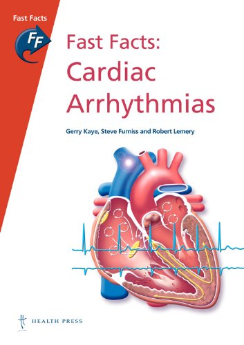 Buy Fast Facts: Cardiac Arrhythmias: Now available: 3rd edition: Fast Facts: Cardiac Arrhythmias — BookShops.in