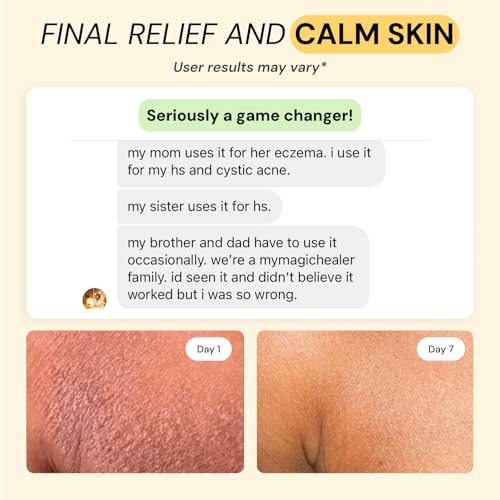 MyMagicHealer Universal Flare Care | Essential Oil Free | Relief for Rashes, Eczema, Psoriasis, Hidradenitis Suppurativa, Impetigo, Dermatitis, Wound Care, Sensitive Skin w/Propolis & Egg Yolk 4 oz