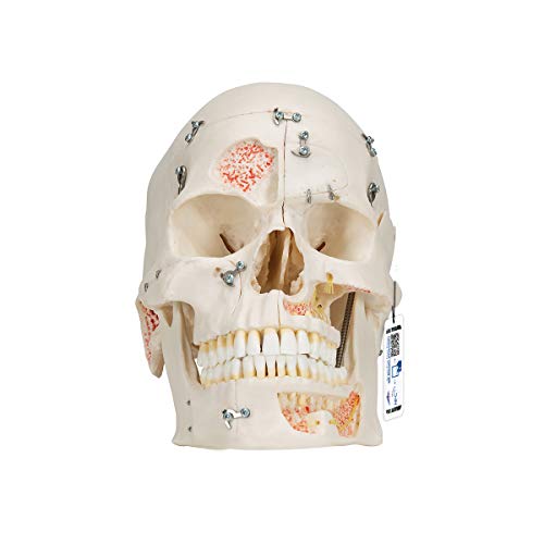 3B Scientific A27 Deluxe Human Demonstration Dental Skull Model, ...