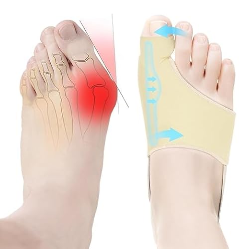 Correcteur d'oignon pour homme et femme, séparateur de gros orteil, entretoises orthopédiques pour homme et femme, attelle orthopédique pour soulager l'oignon, l'hallux valgus, confortable et