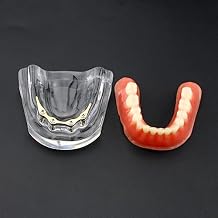 Dental Teeth Model Inferior Overdenture Precision 4 Implants Golden/Silver Bar M6008S