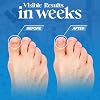 Aromasong Tea Tree Foot Soak with Dead Sea Salt & Magnesium Flakes Refreshing Foot Bath Salts for Relaxation, Odor Control & Soft Skin (Packaging May Vary)