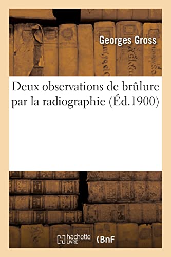 Deux observations de brûlure par la radiographie (French Edition)