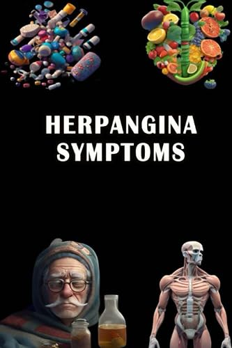 Herpangina Symptoms: Identify Herpangina Symptoms - Recognize Mouth and Throat Infection Risks in Children!