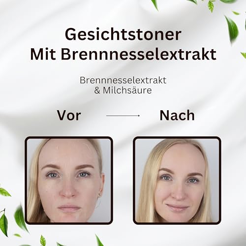 CallistaÉVA Tónico facial con ortiga [fabricado en Alemania] – Tóner sin alcohol para pieles sensibles, secas y grasas, calmante y equilibrador de pH, vegano, 200 ml - imagen 6