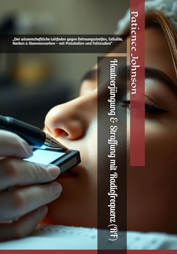 Hautverjüngung & Straffung mit Radiofrequenz (RF): „Der wissenschaftliche Leitfaden gegen Dehnungsstreifen, Cellulite, Narben & Stammesnarben – mit Protokollen und Fallstudien“