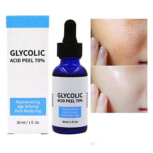 Ardorlove Glycolic Acid Peel 70% - Shrink Pores Brighten Skin Color Balance Water And Oil Intense Anti-Aging Treatment For Wrinkles Fine Lines Brown Spots And Acne Scarring #TOP4