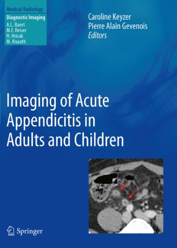 Imaging of Acute Appendicitis in Adults and Children (Medical Radiology) (English Edition)