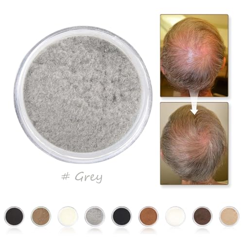 Zentanmei Hair Fibers For Thinning Hair For Women All-Natural Hair Building Fibers 0.98 Oz Hair Volume Powder Bald Spot Cover Up For Men & Women thumb #2