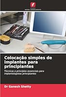 Colocação simples de implantes para principiantes (Portuguese Edition) 6200712921 Book Cover