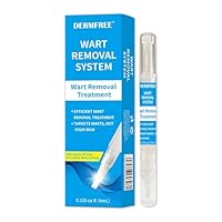 Warzenentfernungsstift für Körper und Hände – für alle Hauttypen geeignet (4ML)