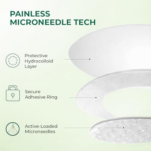 Image of Conscious Chemist Self Dissolving Microneedle Acne Patches (Pack of 8 Patches) | Painless & Effective Pimple Patches with 2% Salicylic Acid, Azelaic Acid & Niacinamide | Kills Bacteria, Reduces Redness, Scarring & Excess Sebum | Visible Results in 6 Hours