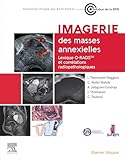  Imagerie des masses annexielles: Lexique O-RADS et corrélations radiopathologiques