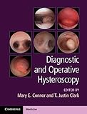 hysteroscopy video  Diagnostic and Operative Hysteroscopy