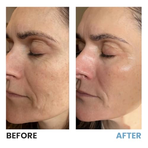 Image of GLOKORE Bio Collagen Face Mask, Overnight Hydrating Face Mask with Hyaluronic Acid, Peptides & Niacinamide, Firming & Plumping Skincare for Glowing-Looking Skin (Pack of 4)