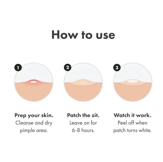 Miniatura 3 de ClearPatch - Parches para acné clínicamente probados, 36 unidades, calcomanías hidrocoloides para una rápida cobertura y curación de imperfecciones.