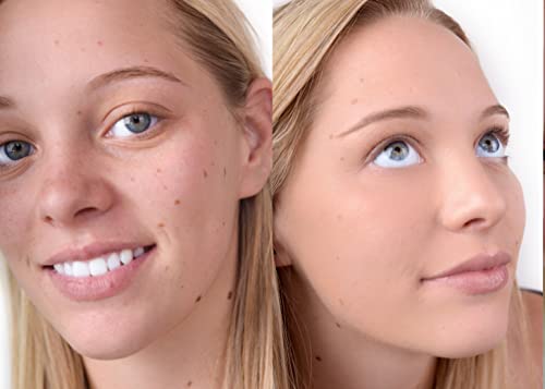 The Good Mineral Loves-You-Back 3In1 Mineral Powder Foundation (Beige 1) | Designed For Acne-Prone, Sensitive Skin. #TOP5