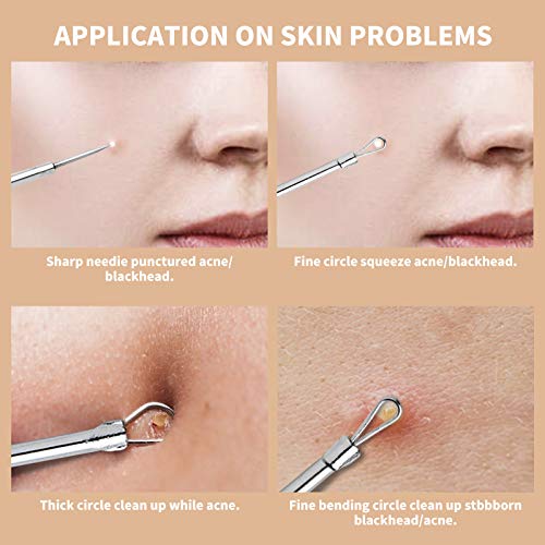 Top 10 Best blackhead remover pimple extractor acne comedone blemish