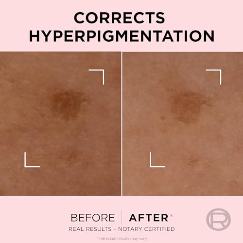 L'Oreal Paris Age Perfect Golden Age Rapid Spot Corrector for Mature Skin Niacinamide and Exclusive Peony Native Cells - Image 4
