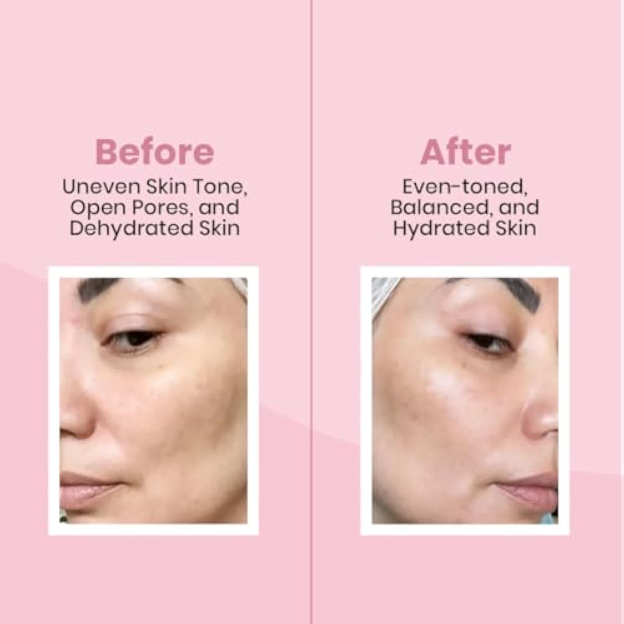 Facial Toner with Rose Extract for Hydration and Refreshing