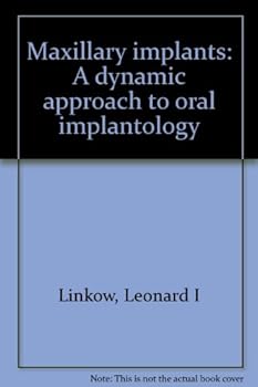 Unknown Binding Maxillary implants: A dynamic approach to oral implantology Book