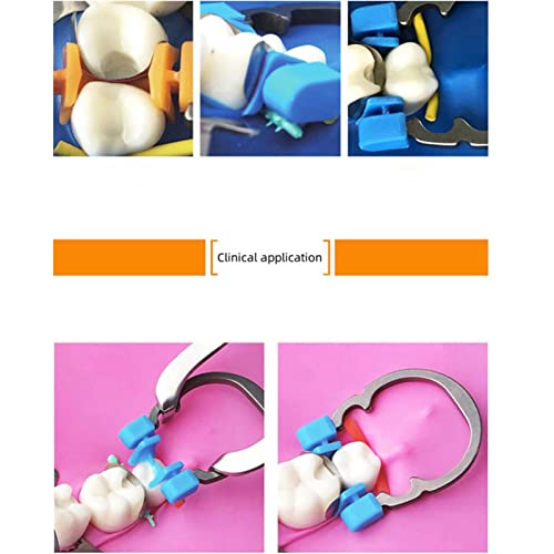 Image of Dental Sectional Matrix Ring Clamp Spring Clip, Autoclavable Nickel Titanium Orthodontic Clamp Rings, Contoured Matrices System for Pre and Post Molars. (R2 Orange)