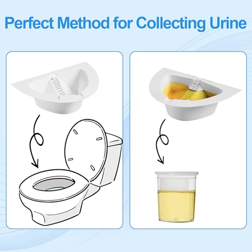 Image of 25 Pack Urine Collection Hats for Toilet, Specimen Collector Pans 40oz /1200cc with Clear Readings, Universal Urine Pee Stool Sample Collection Kit for Women and Elderly