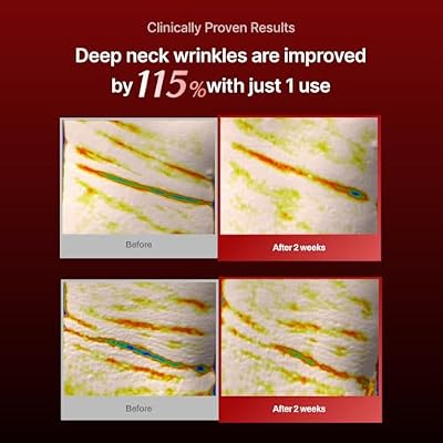Wrinkle-fit Neck Mask & Wrinkle-fit Tangle Eye Patch - Firming and Tightening Korean Collagen Mask - Hydrating and Lifting Effect for Glowing Skin, Under Eye Mask for Eye Bags and Puffiness