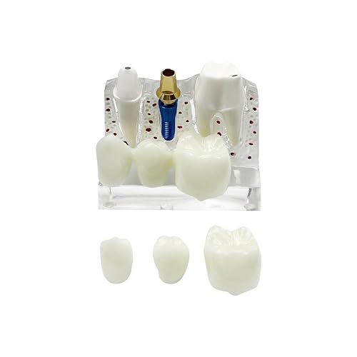 Miniatura 52 de 2 modelos de dientes estándar, modelo dental para adultos, modelo estándar de demostración de Typodont para niños, enseñanza dental, pantalla