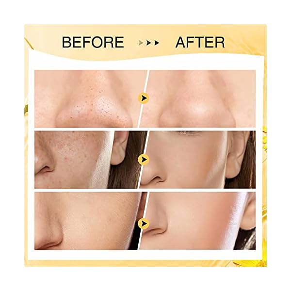 Turmeric-Clay-Stick-Mask-Organic-Vitamin-C-Purifying-Clay-Mask-Blackhead-Cleansing-Healing-Clay-Mud-Mask-Deep-Clean-Pore-Improve-Skin-Acne-Scars-Facial-Mask-With-Blackhead-Remover-Extractor-ToolS Turmeric Clay Stick Mask Organic Vitamin C Purifying Mask for Blackhead Cleansing Healing Clay Mud Mask for Deep Clean Pore Improve Skin Acne Scars Facial Mask With Blackhead Remover Extractor Tools