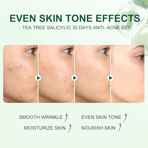 Skincare Mini Kit, Tea Tree Skin Care Sets & Kits, Acne Skincare Set Gifts, Anti Acne Facial Kit Gifts for Women,Cleanser, Toner, Serum, Cream,Oil Control Facial Kit, Airplane Friendly Sizes