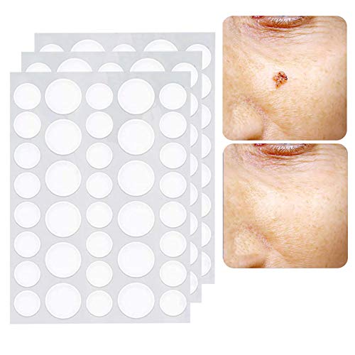 Wart Remover, Wart Removal Patches Wart Removal Treatment Skin Tag Remover Pads for All Skin Types(144 Patches)