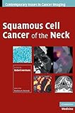 Squamous Cell Cancer of the Neck (Contemporary Issues in Cancer Imaging)