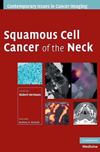Squamous Cell Cancer of the Neck (Contemporary Issues in Cancer Imaging)
