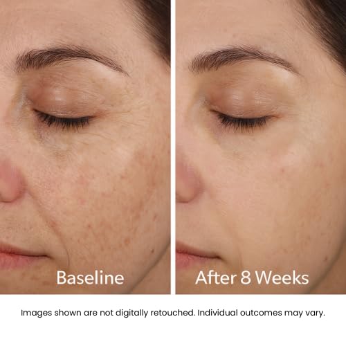 Anti-Aging Gel-Cream for Face & Neck | Peptide & Hyaluronic Acid Moisturizer to Smooth Fine Lines & Wrinkles, Firm Skin | Lightweight, Non-Greasy Daily Gel Cream | Made in USA - Image 6