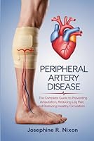 Peripheral Artery Disease: The Complete Guide to Preventing Amputation, Reducing Leg Pain, and Restoring Healthy Circulation . B0DYYH89VG Book Cover