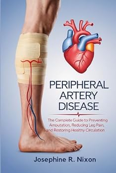 Paperback Peripheral Artery Disease: The Complete Guide to Preventing Amputation, Reducing Leg Pain, and Restoring Healthy Circulation . Book