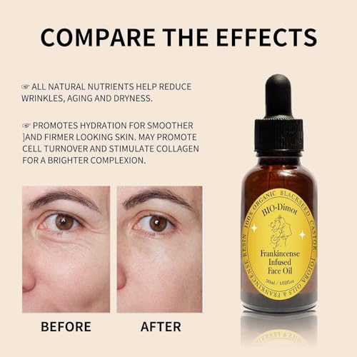 2PC Frankincense Resin Oil Infused Organic Black Seed, Castor & Jojoba Oils for Face Anti-Aging Miracle Facial Moisturizer, Anti-Wrinkles Natural Skincare Hydrates Skin(30ml)