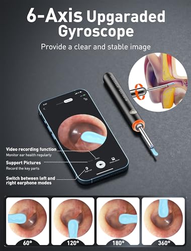 Image of Yorsfun Ear Wax Removal, 3 in 1 Earwax Removal Kit, 1080P HD Ear Cleaner with Camera, FSA HSA Eligible, Otoscope with 7 Ear Spoon, Ear Cleaning 6 LED Lights 6 Ear Tips, Ear Camera for iOS & Android