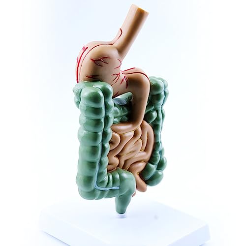 Modèle de système digestif AMITD pour comprendre le côlon pathologique - 5