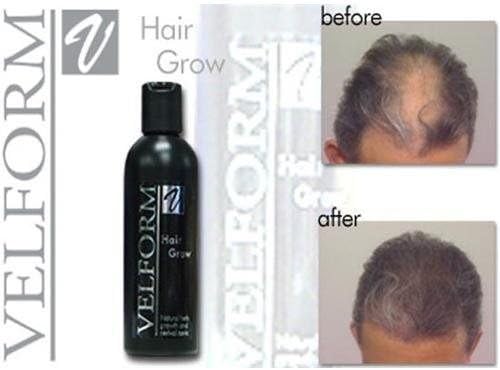 Velform Natural Hair Grow Tonic Stimulates Hair Growth Stop Hair Loss Hair Fall 200 Ml. Pack of 2