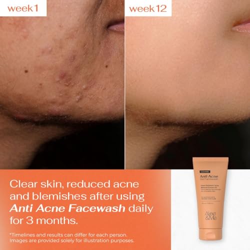 Image of Aloe & Me Anti Acne Face Cleanser With Orange Cape Aloe | Reduces Acne and Unclogs Pores 100 ml