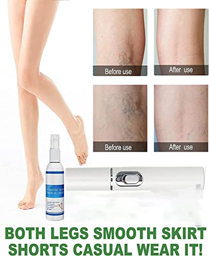 Veinfix Varicose Treatment Spray Set - Veinshealth...