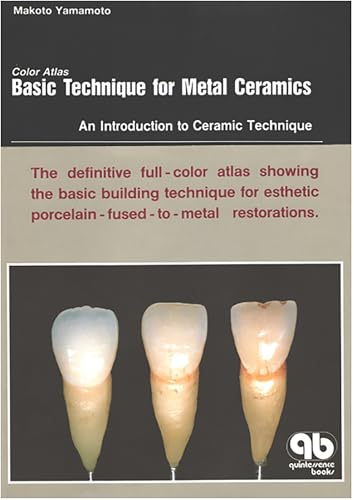 Color Atlas Basic Technique for Metal Ceramics: An Introduction to Ceramic Technique (English Edition)