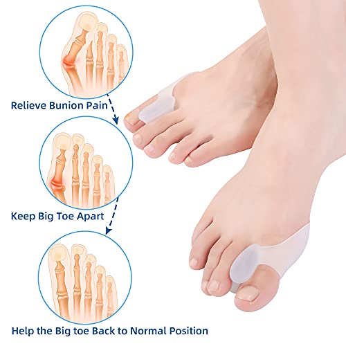 Hoogoo Silicone Bunion Corrector Shield For Big Toe 10Pcs Hammer Toe Corrector Bunion Pads Gel Protector Separator Toe Spacer Spreader Toe Separator For Overlapping Toes For Feet Women And Men #TOP2